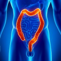 polipo_de_intestino